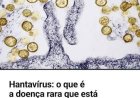 OMS PROCURA MAIS DE 80 PASSAGEIROS APÓS CASO HANTAVÍRUS EM VOO INTERNACIONAL